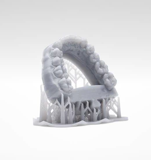 Occlusodontie